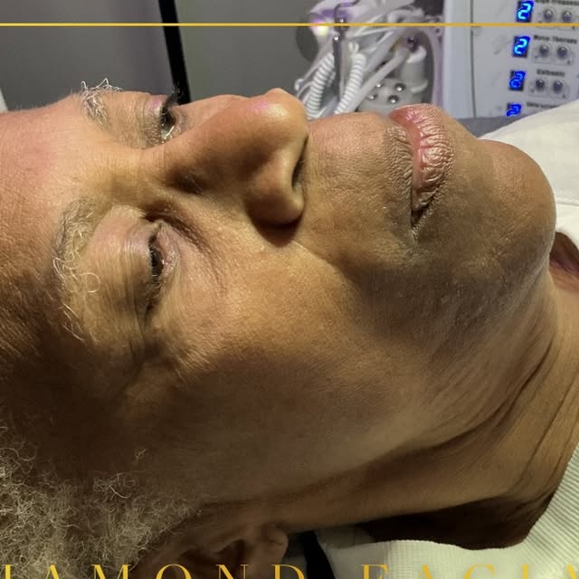 A diamond facial in progress